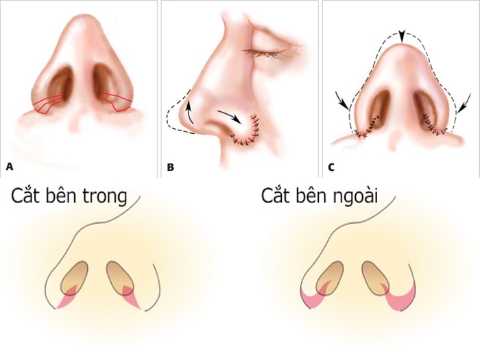 cat-canh-mui-3.jpg