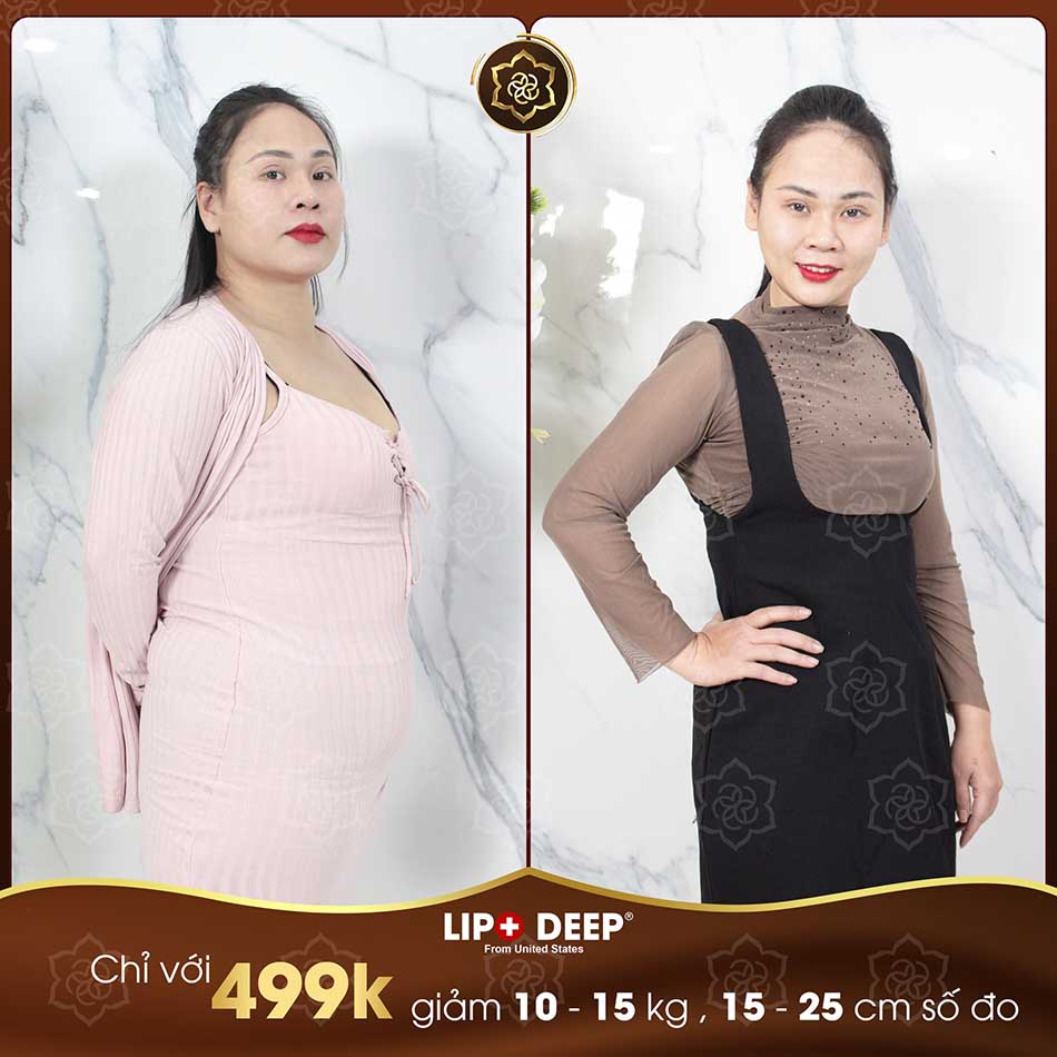 cong-nghe-lipo-deep.jpg