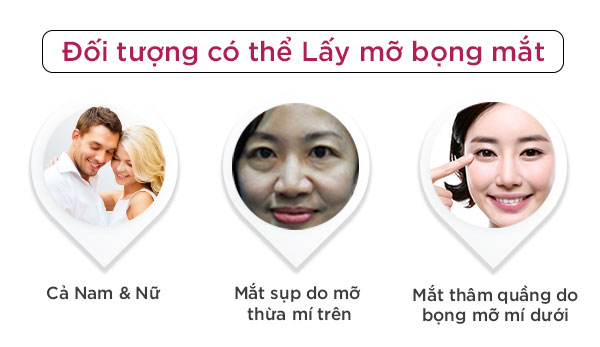 doi-tuong-lay-bong-mo-mat-1.jpg