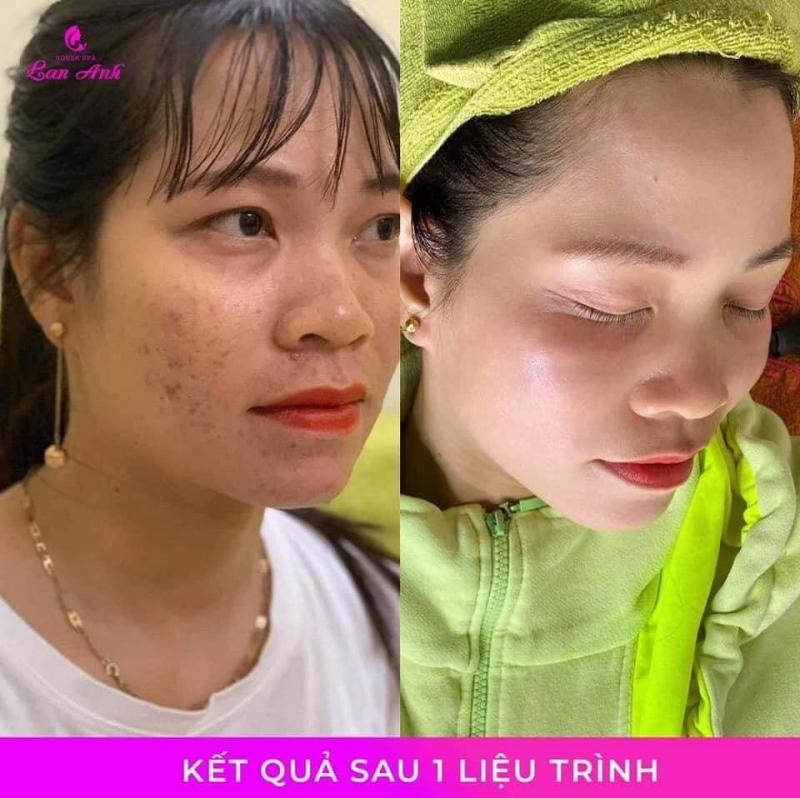 lan-anh-house-spa-716649.jpeg