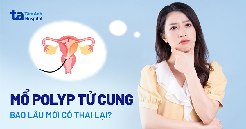 mo-polyp-tu-cung-bao-lau-moi-co-thai-lai.jpg