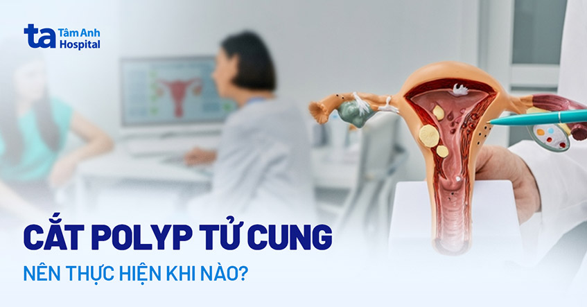 phau-thuat-cat-polyp-tu-cung.jpg