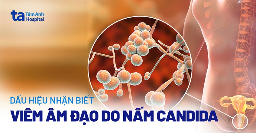 viem-am-dao-do-nam-candida-vung-kin.jpg