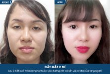 cat-mi-mat-4.jpg